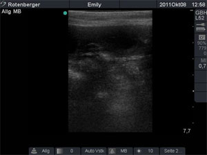 Ultraschall-Emily-D-Wurf Ultraschall-Emily-D-Wurf